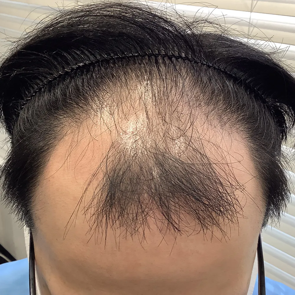 ウィルAGAクリニック 千葉院の症例写真