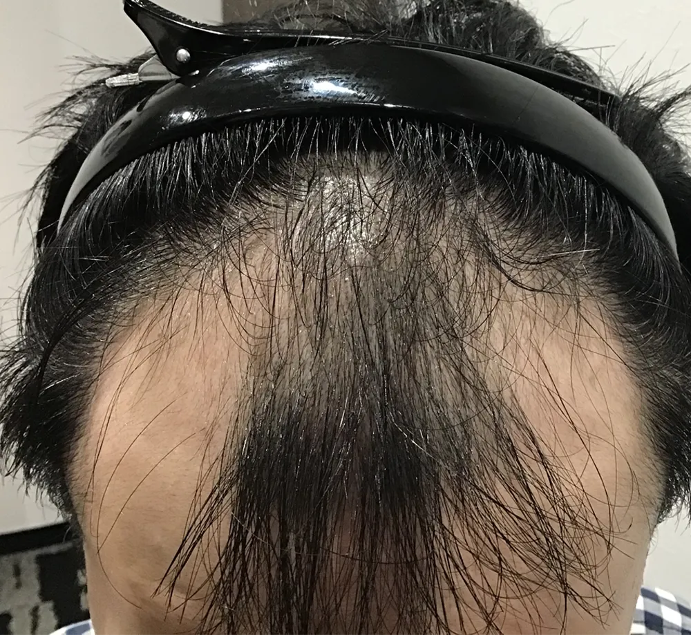 ウィルAGAクリニック 千葉院の症例写真