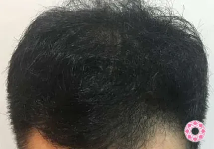 東京形成美容外科の症例写真