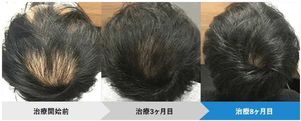 AHCメディカルサロンの症例写真