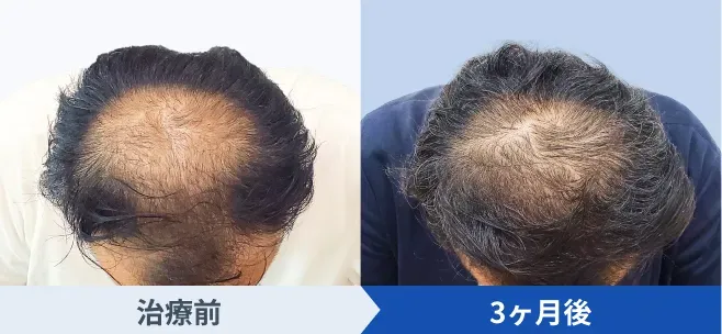 DMMオンラインクリニックの症例写真