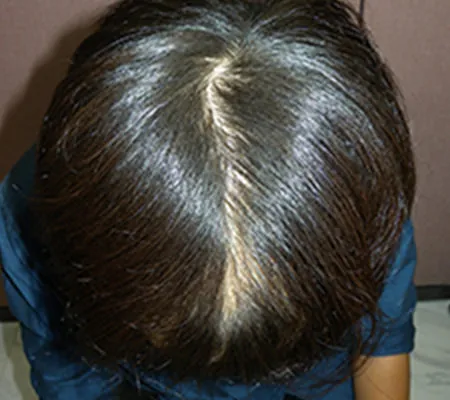 Oops HAIRの症例写真