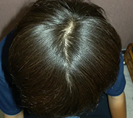 Oops HAIRの症例写真