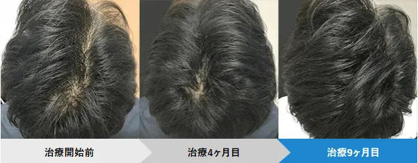 AHCメディカルサロンの症例写真