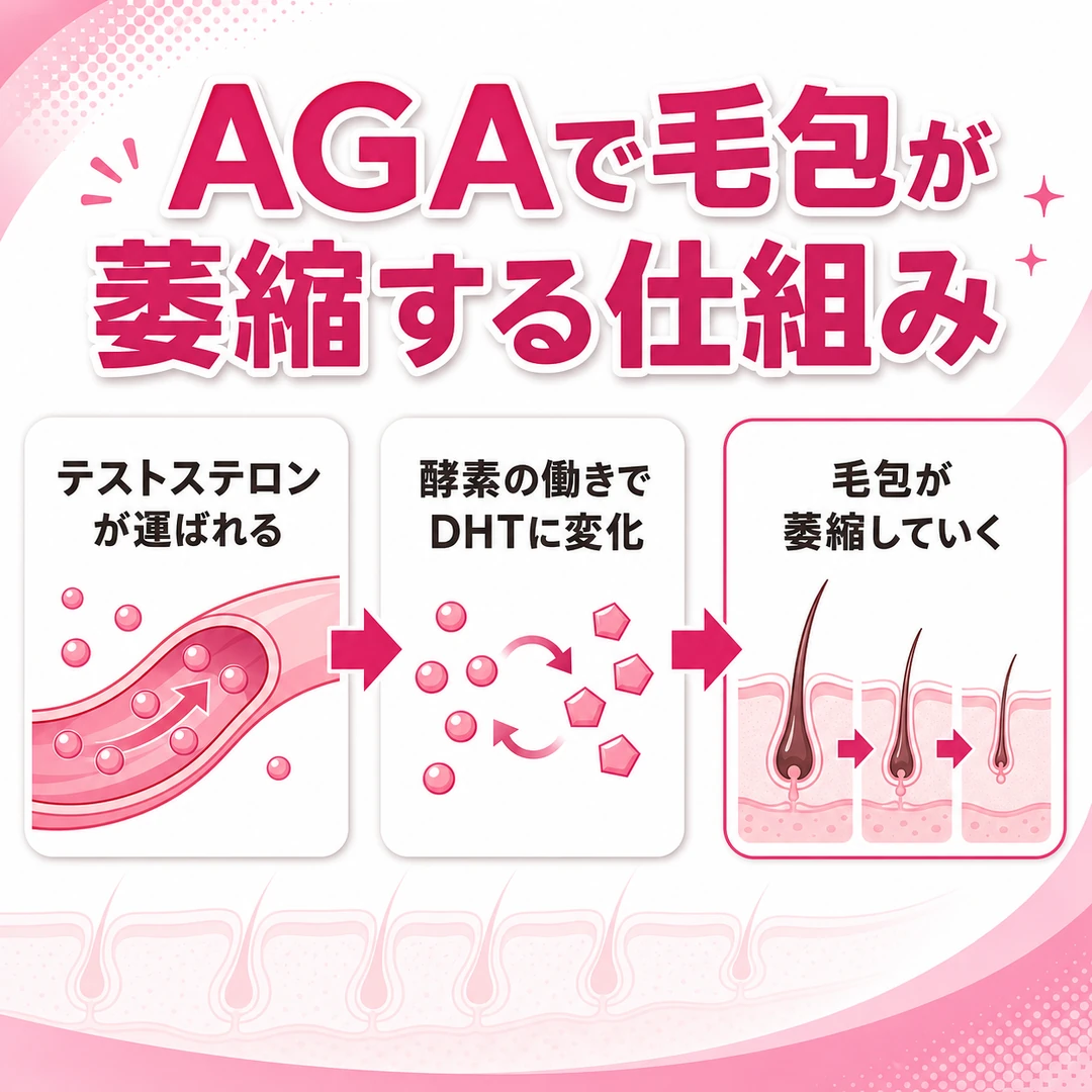 AGAで毛包が萎縮する仕組みを左から右へ示した図。テストステロンが運ばれ、酵素の働きでDHTに変化し、毛包が萎縮していく流れ