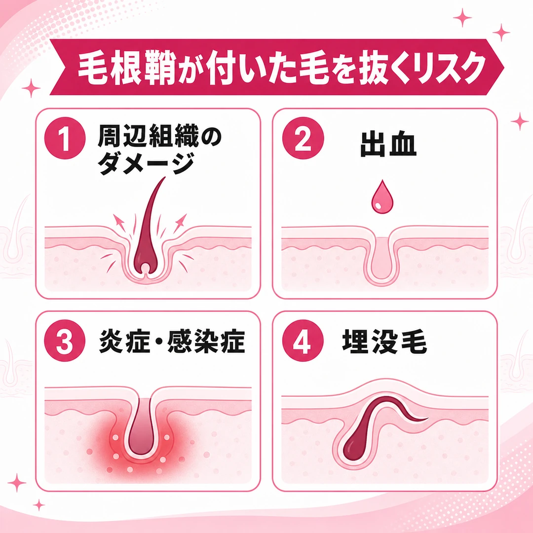 毛根鞘が付いた毛を抜いたときのリスクを4つ並べた図。周辺組織のダメージ、出血、炎症・感染症、埋没毛