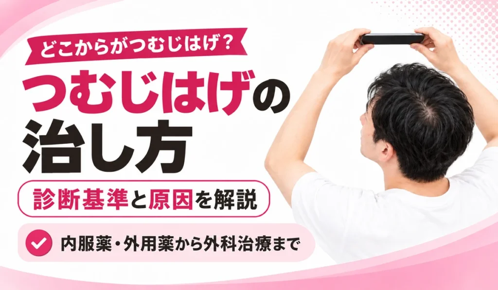 つむじはげの治し方と診断基準・原因の解説を掲げ、スマートフォンを頭上にかざして頭頂部を撮影する男性を配した図