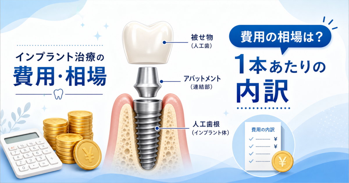 インプラント治療の相場｜1本あたりの費用や金額の内訳とは？