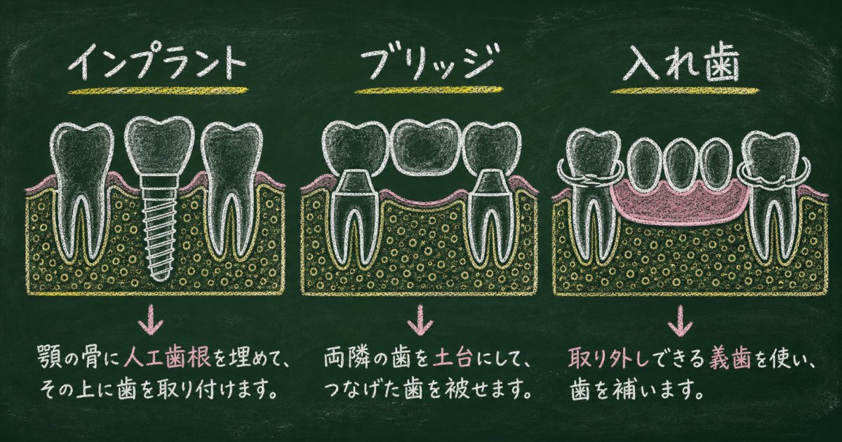 歯を補う3大治療法の仕組みとそれぞれの特徴