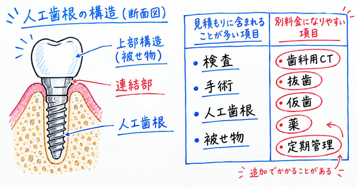 人工歯根1本の費用は何を含む金額か