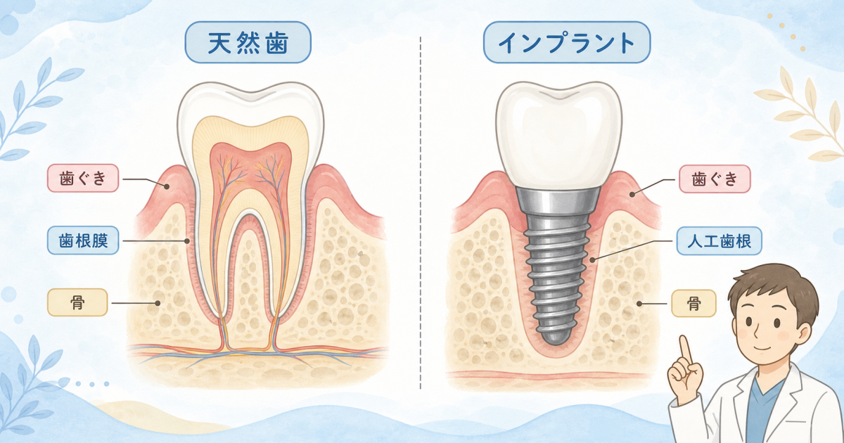 インプラントの出血は歯周病と違う？進行速度と症状の特徴を解説