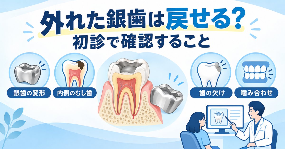 外れた銀歯は戻せる？初診で何を調べる？
